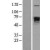 Western Blot: 68kDa Neurofilament Light Lysate [NBL1-13577] - Western Blot experiments. 
Left-Control; Right -Over-expression Lysate for NEFL